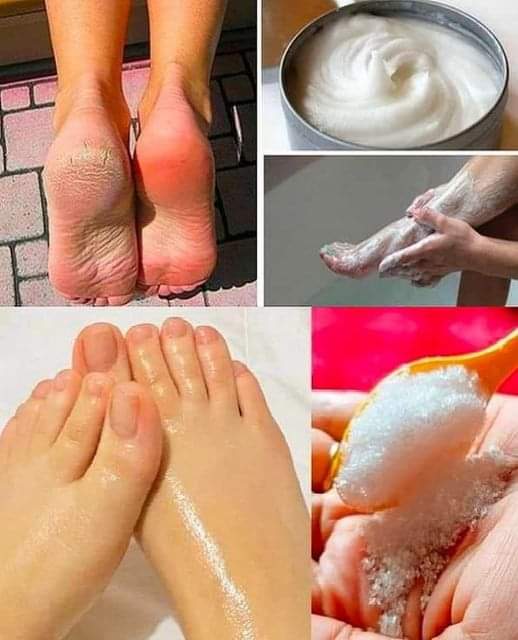 Here’s How to Do a Pedicure at Home with Baking Soda