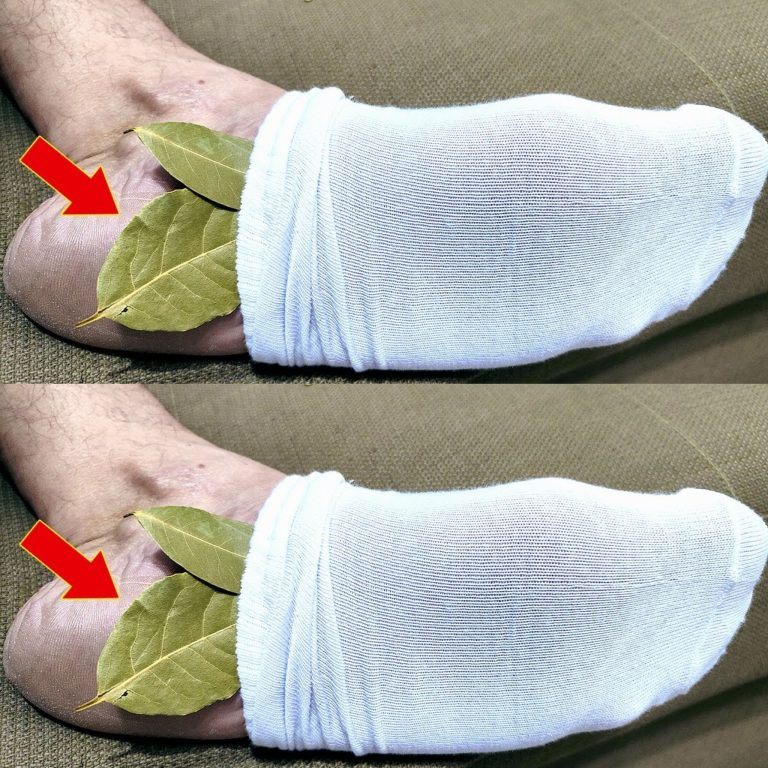 Put 1 Bay Leaf on Your Feet and No Longer Need to Spend Money at the Pharmacy (Did You Know That?)