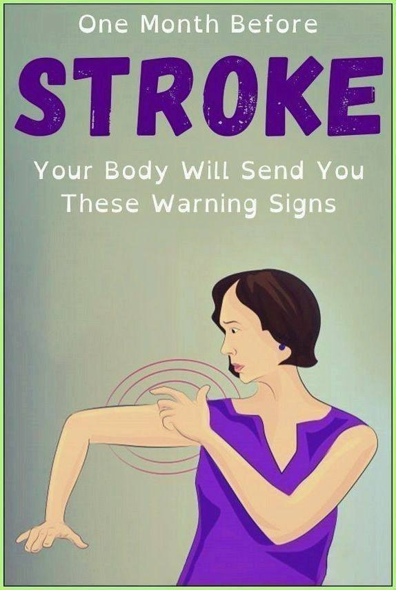 Stroke: These warning signs that appear 1 month before