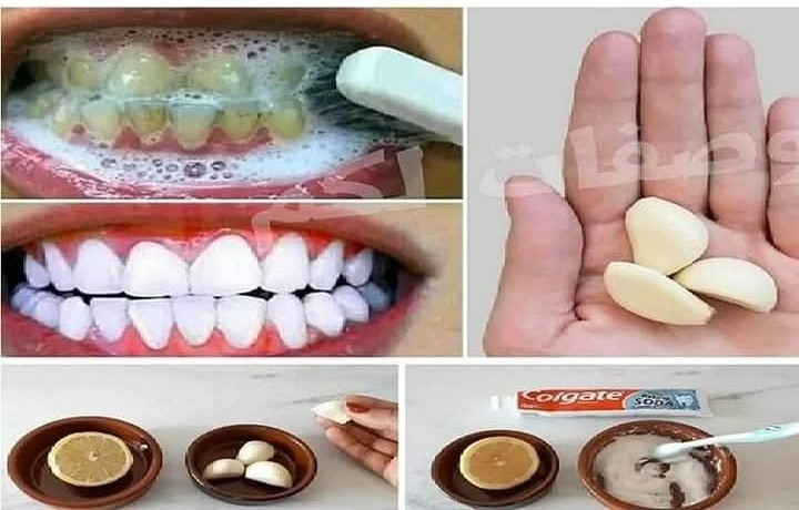 Here’s How to Whiten Yellow Teeth, Remove Plaque and Tartar Buildup