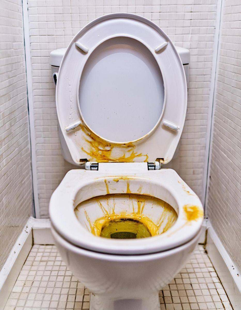 Got yellow stains on underside of toilet seat? Here’s how to get rid of them