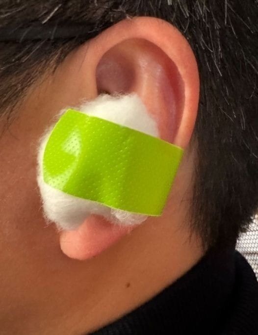 Put a cotton ball with VapoRub in your ear for a good result