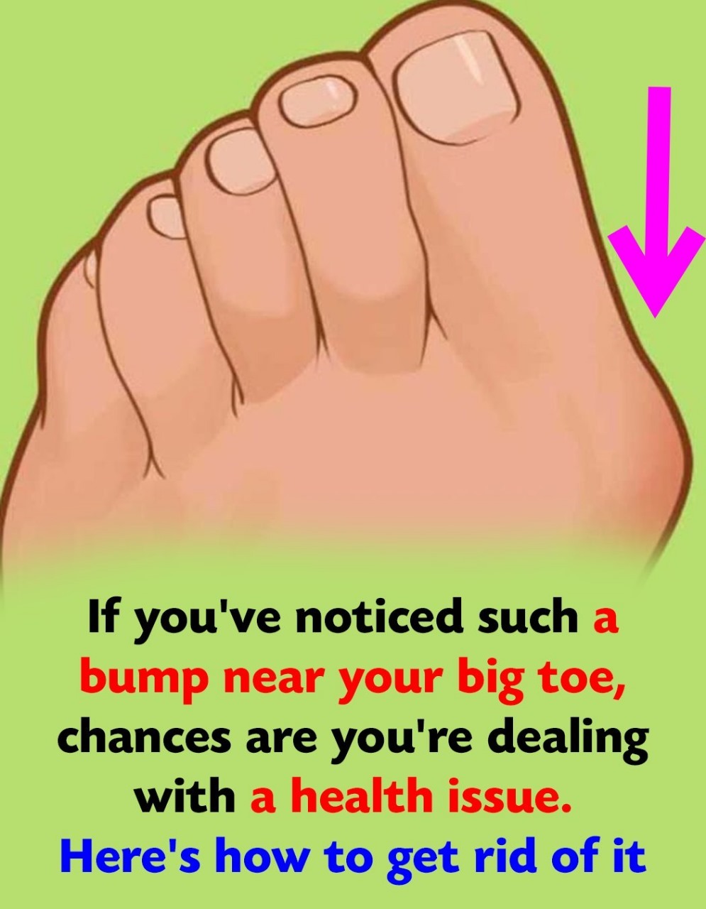 The painful bump on the side of your feet