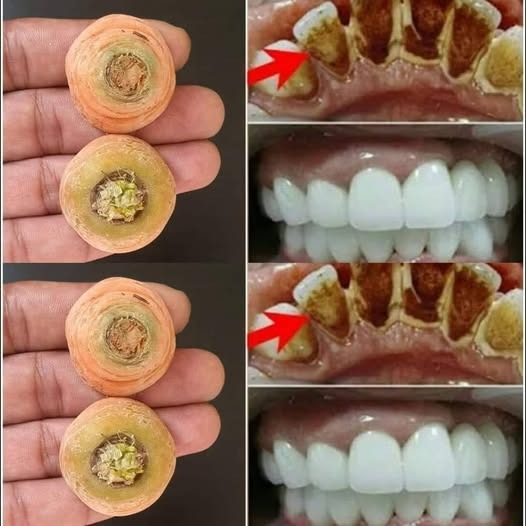 Recipes Brighten Your Smile Naturally With Carrot Tips: A Simple Home Remedy To Whiten Teeth