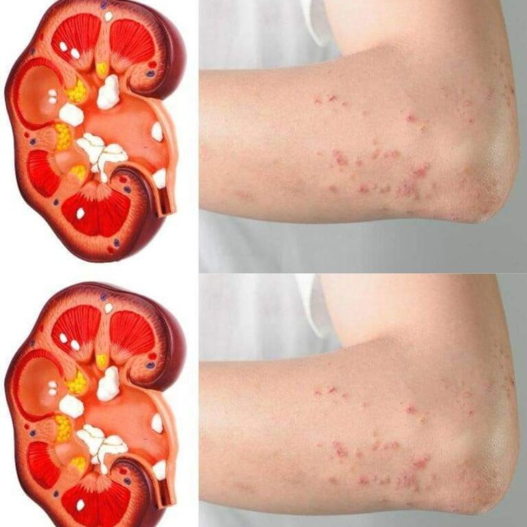 If your kidneys are in danger, the body will give you these 8 signs!