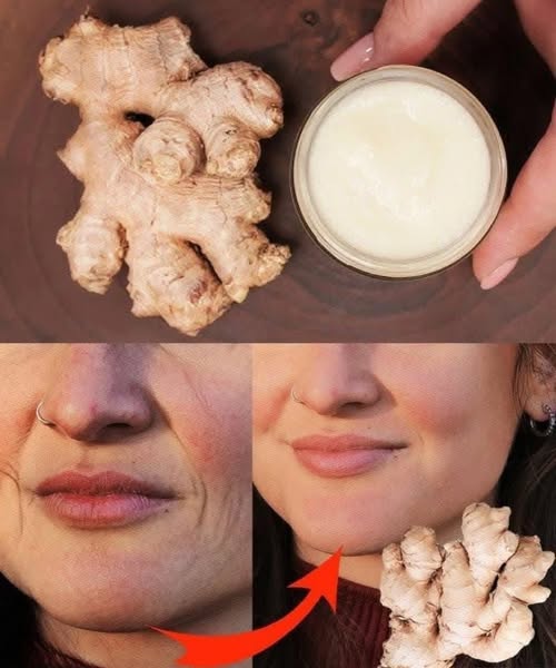 Ginger A Natural Alternative to Botox for Wrinkle Reduction