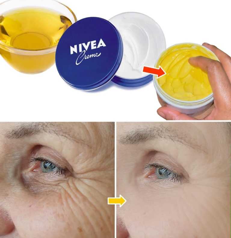 Mix Nivea cream and olive oil to rejuvenate your face by 10 years