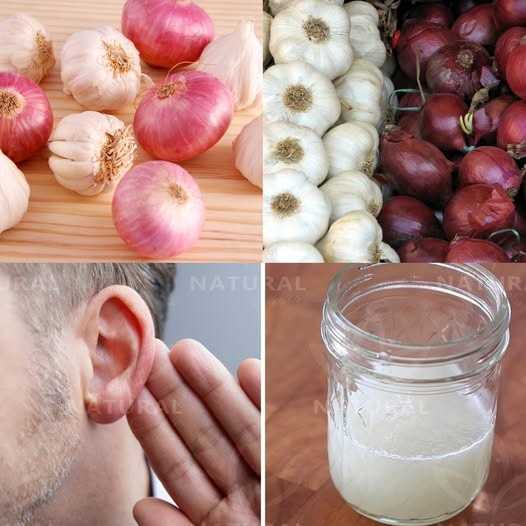 Garlic and Onion: Natural Remedies for Improving Hearing Loss