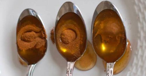 Honey and Cinnamon – A Blend that Cures 15 Diseases: The Effect is Praised Even by Doctors, Save this Recipe Well