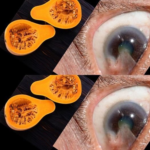 The Astonishing Benefits of Pumpkin for Vision: A Life-Changing Experience