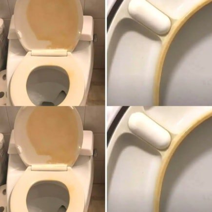 Goodbye, yellow streaks on the toilet, cleaning products do not solve anything: this is the only way to get rid of the problem