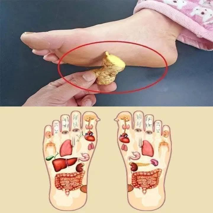 Put 1 ginger on your feet and stop spending money at the pharmacy